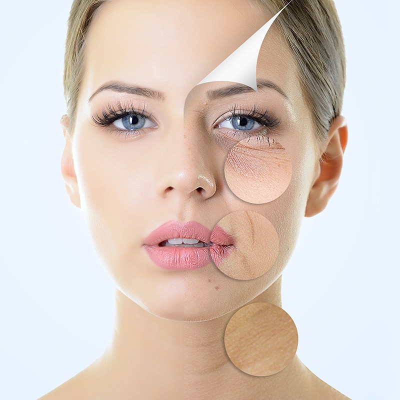 Age Corrective Facial