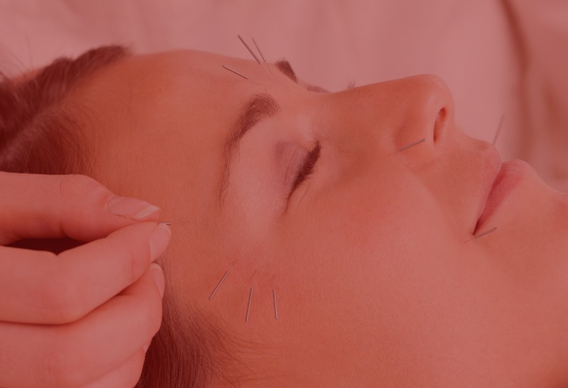 Anti-aging Acupuncture Facial with LED Light Therapy