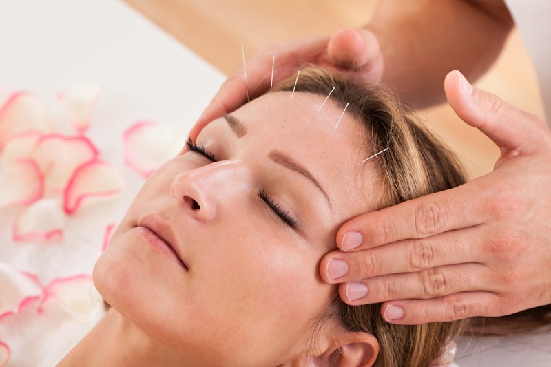 Anti-aging Acupuncture Facial