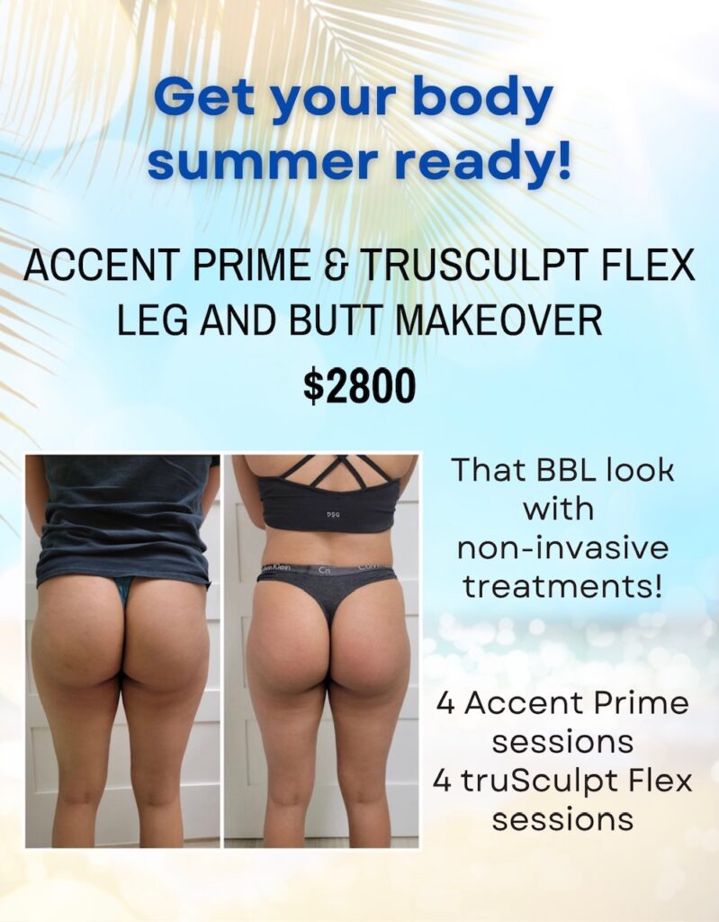 Get Swimsuit-Ready With Accent Prime Body Sculpting Treatment