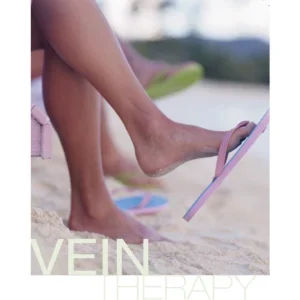 Cutera Laser Vein Removal