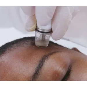 Diamond Glow Wet Microdermabrasion